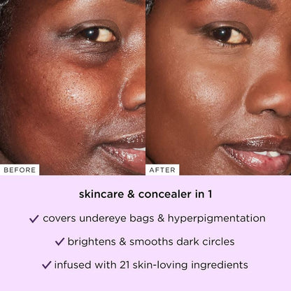 Blurr.™ Concealer Stick